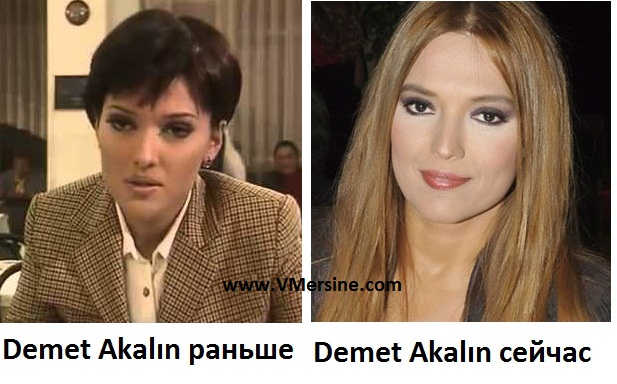 Demet Akalın1