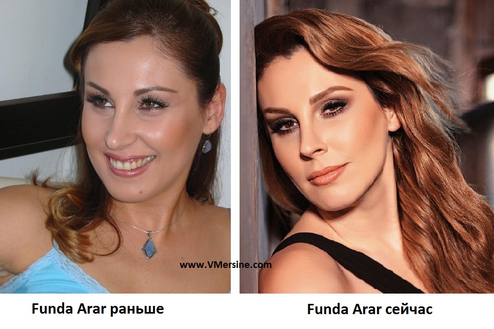 Funda-Arar