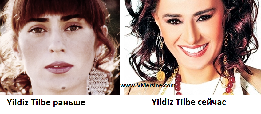 Yıldız Tilbe