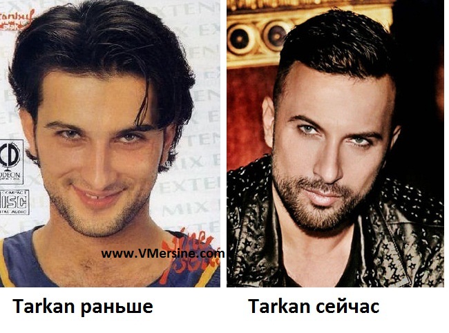 Tarkan Tüm Albümleri